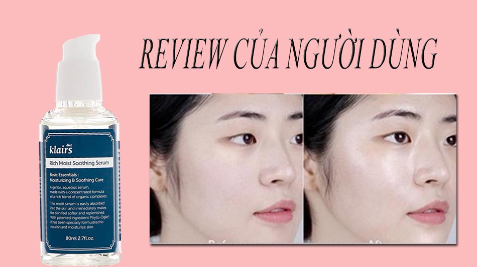 Review của người dùng