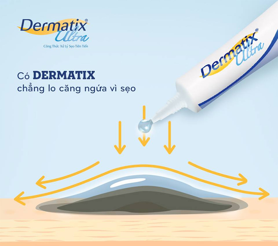 Trị sẹo Dermatix Ultra Gel
